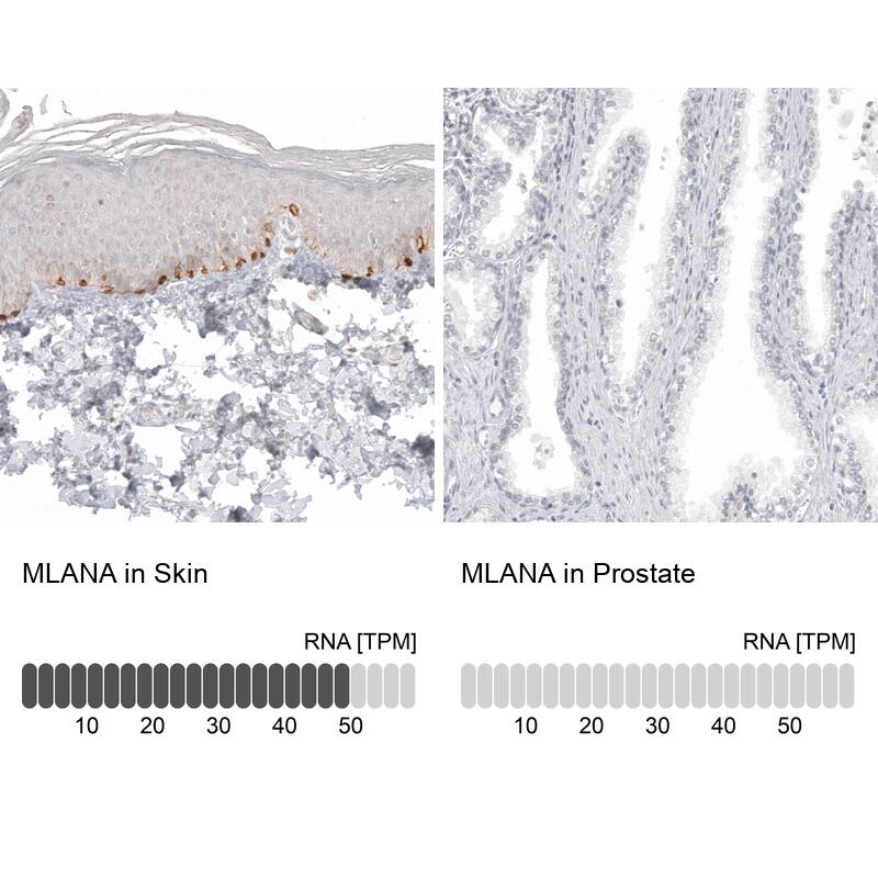 Analysis in human skin and prostate tissues using NBP3-44176 antibody. Corresponding Melan-A/MART-1 RNA-seq data are presented for the same tissues.