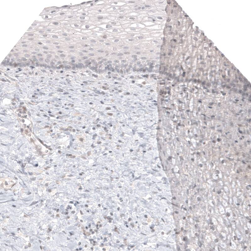 Staining of human cervix shows no positivity in squamous epithelial cells as expected.