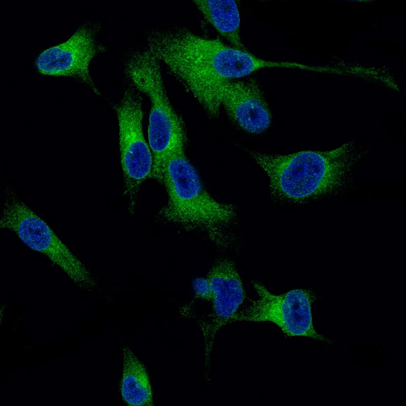 Staining of SK-MEL-30 cells using the Anti-Melan-A/MART-1 monoclonal antibody) .