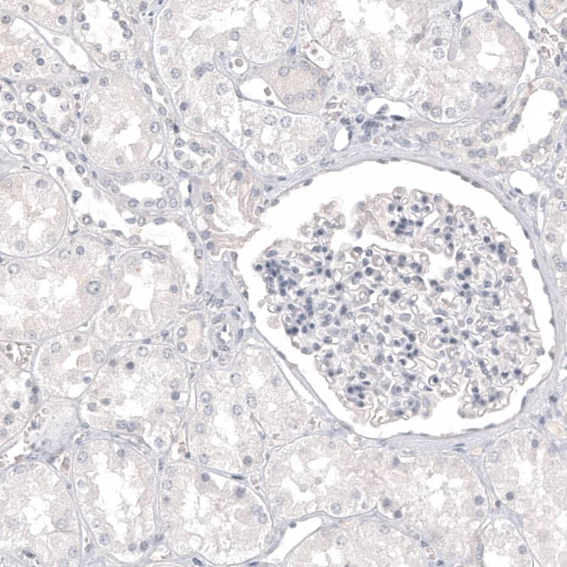 Staining of human kidney shows no positivity as expected.