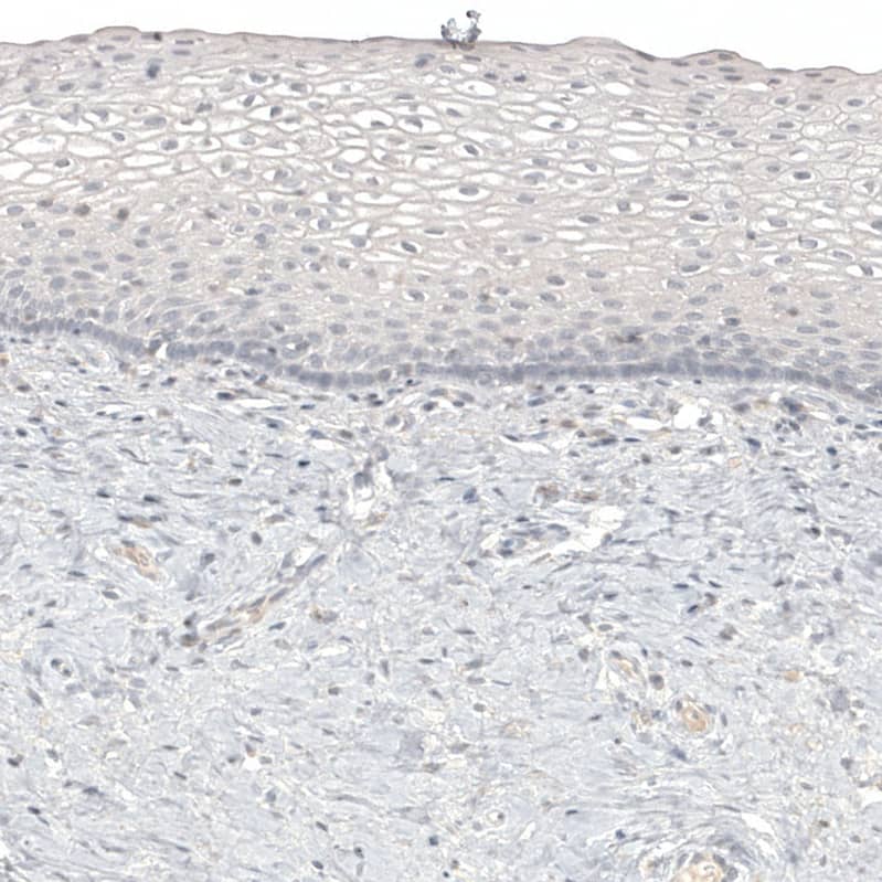 Staining of human cervix shows no positivity in squamous epithelial cells as expected.