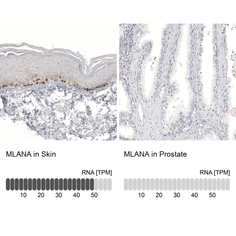 Analysis in human skin and prostate tissues using NBP3-44177 antibody. Corresponding Melan-A/MART-1 RNA-seq data are presented for the same tissues.