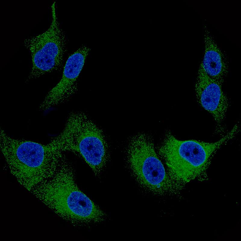 Staining of SK-MEL-30 cells using the Anti-MART1 monoclonal antibody) .