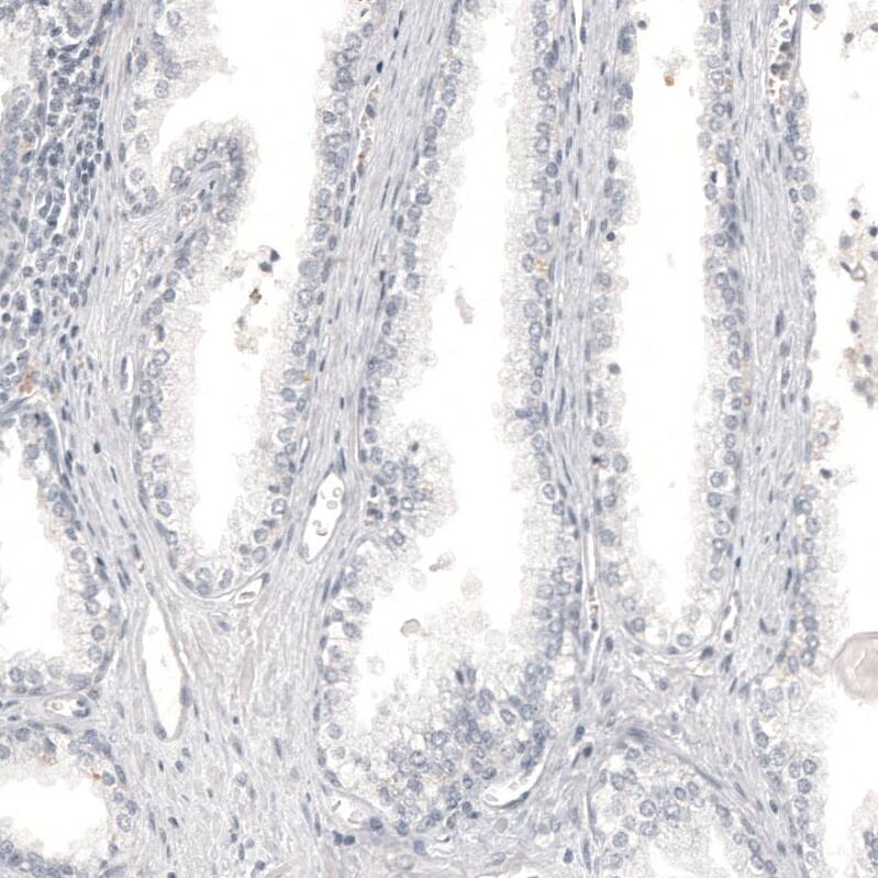 Staining of human prostate shows no positivity in glandular cells as expected.