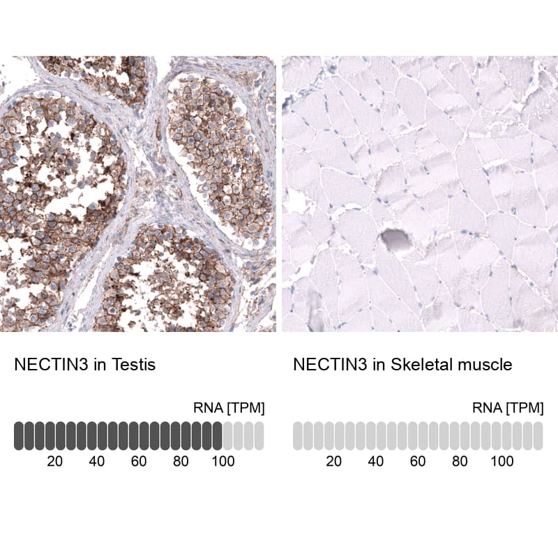 Analysis in human testis and skeletal muscle tissues using NBP3-44181 antibody. Corresponding Nectin-3/PVRL3 RNA-seq data are presented for the same tissues.
