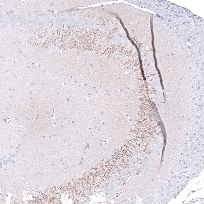 Staining of rat brain shows weak to moderate positivity in neuronal processes in the CA3 area of the hippocampus.