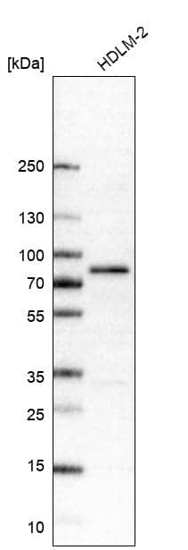 Analysis in human cell line HDLM-2.
