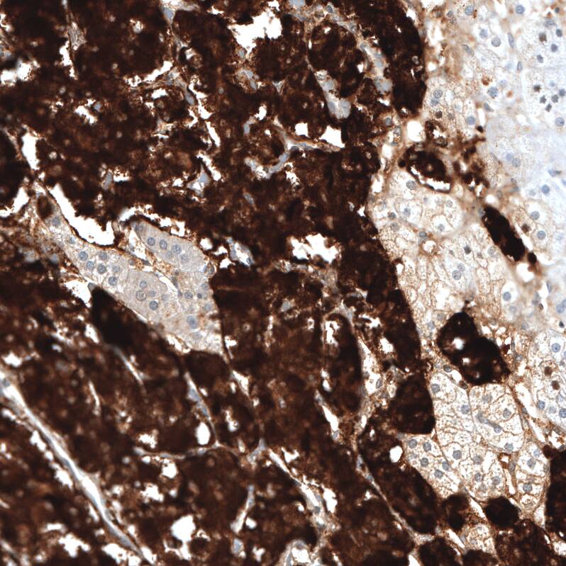 Staining of human adrenal gland shows strong cytoplasmic positivity in neuroendocrine cells.