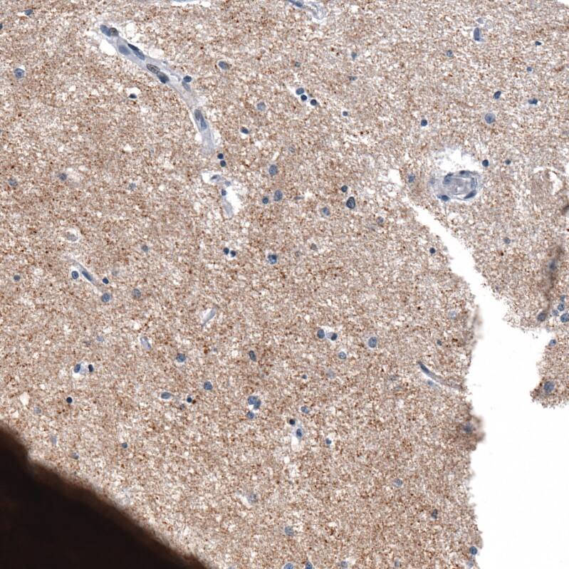 Staining of human cerebral cortex shows moderate cytoplasmic positivity in neuropil.