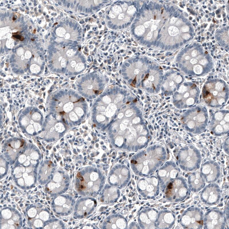Staining of human duodenum shows moderate cytoplasmic positivity in glandular cells.