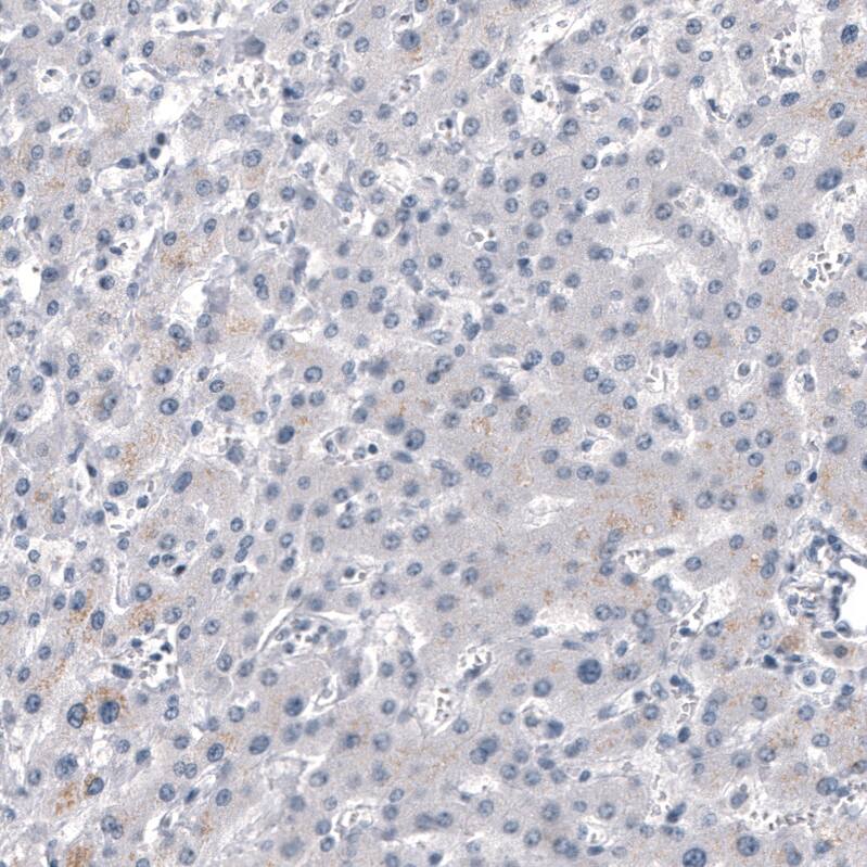 Staining of human liver shows no positivity in hepatocytes as expected.