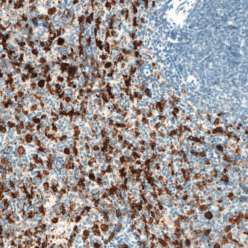 Staining of human spleen shows strong granular cytoplasmic positivity in cells in red pulp.
