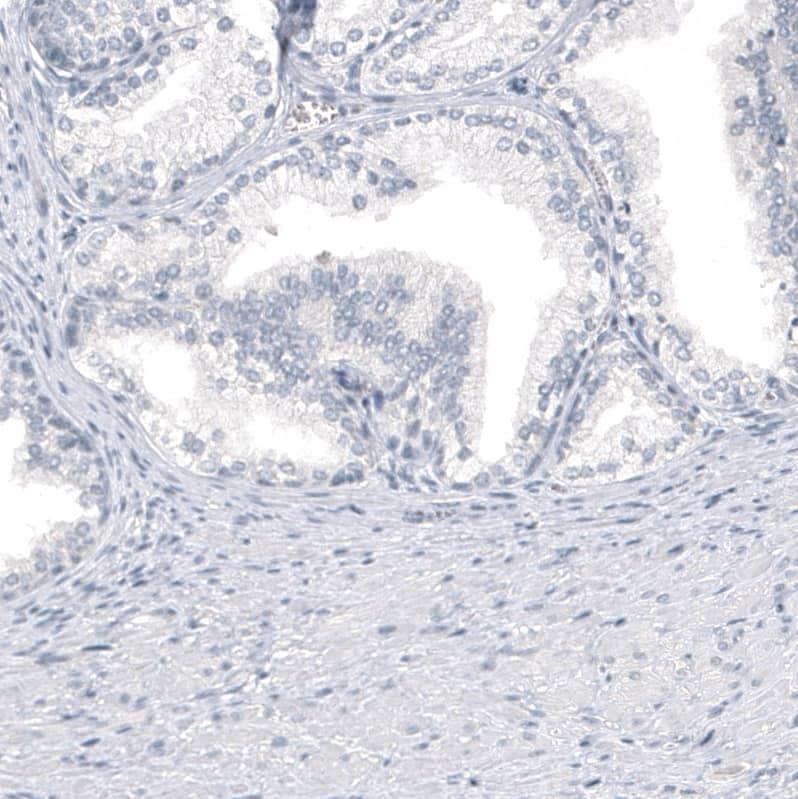Staining of human prostate shows no positivity in glandular cells as expected.