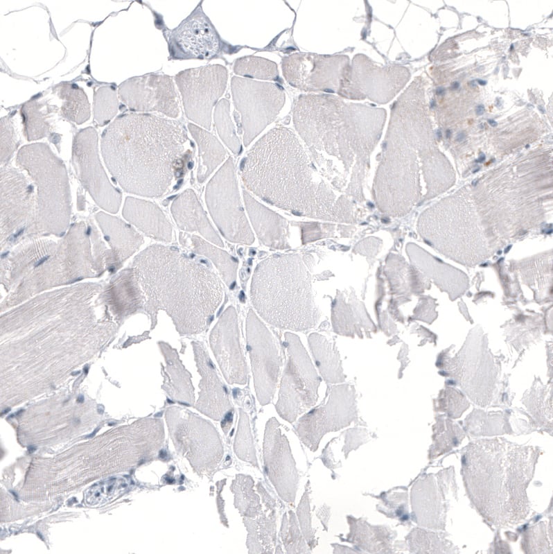 Staining of human skeletal muscle shows no positivity in myocytes as expected.