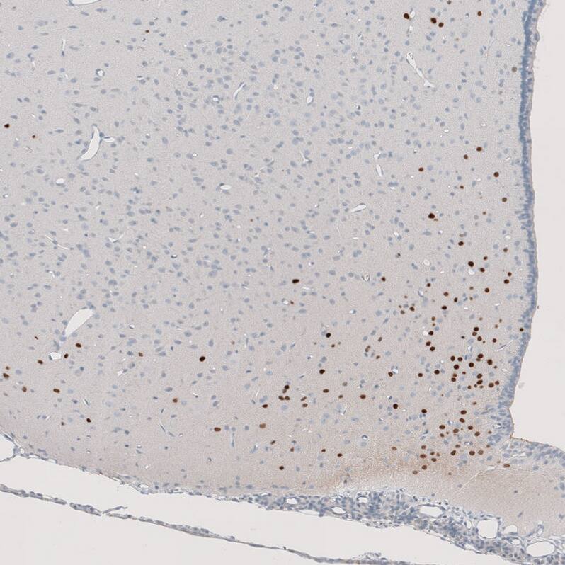 Staining of rat hypothalamus shows strong nuclear positivity in a subset of neurons.