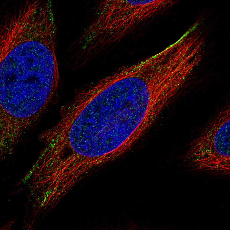 Staining of HeLa cells using the Anti-ROR2 monoclonal antibody) . 