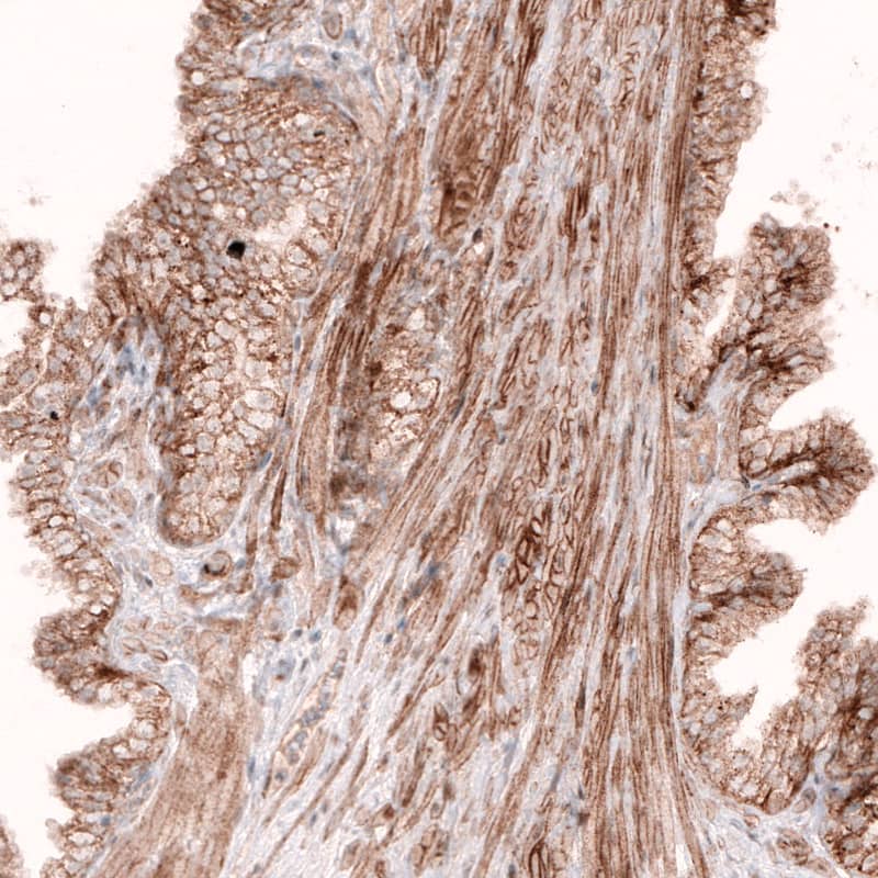 Staining of human prostate shows moderate membranous positivity in glandular cells as well as in smooth muscle cells.