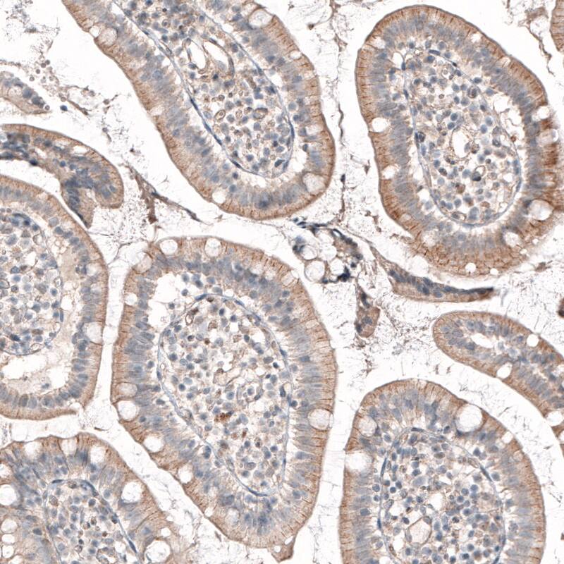 Staining of human small intestine shows membranous positivity in glandular cells.