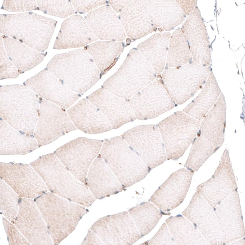 Staining of human skeletal muscle shows absence of membranous positivity in skeletal muscle fibers as expected (negative control).