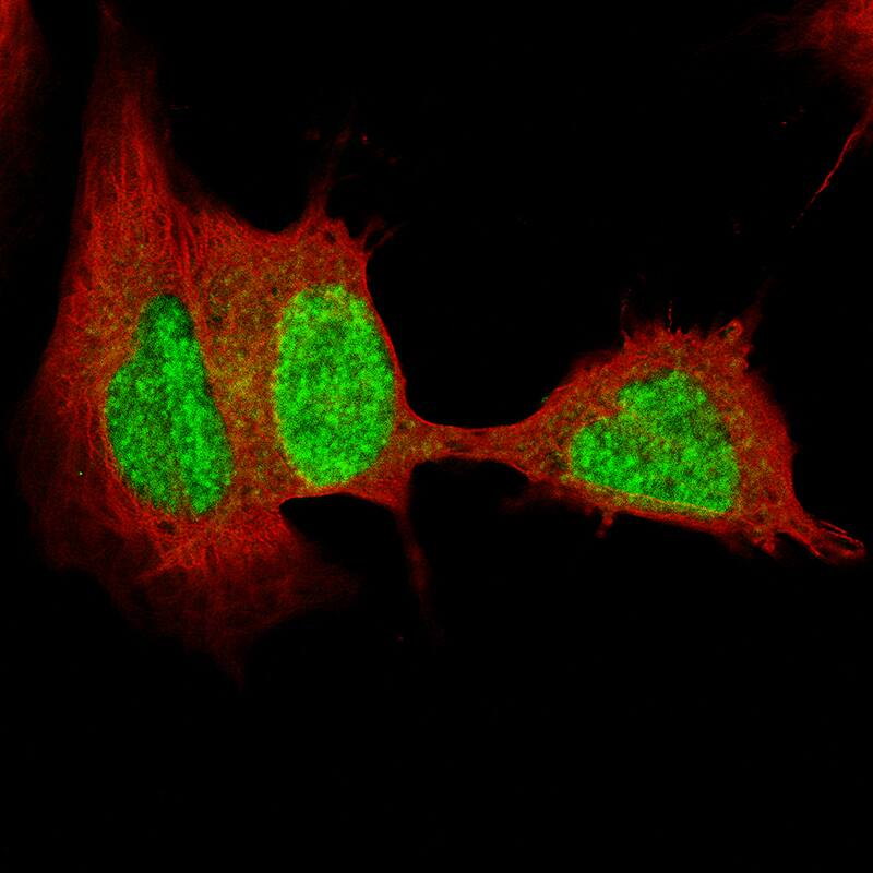 Staining of SH-SY5Y cells, showing specific staining in the nucleoplasm in green. Microtubule- and nuclear probes are visualized in red and blue, respectively (where available).