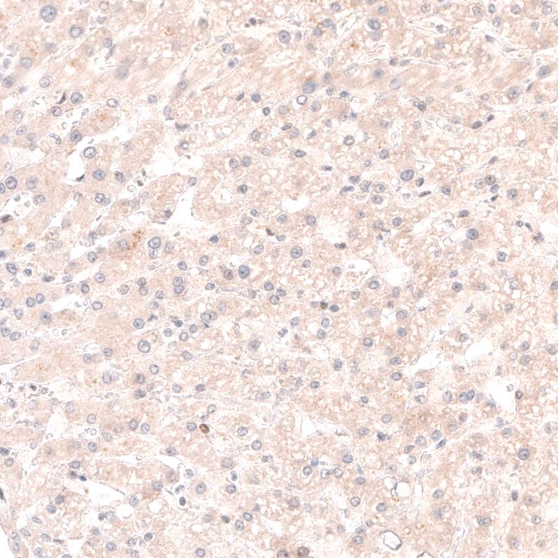 Staining of human liver shows no nuclear positivity in hepatocytes as expected.