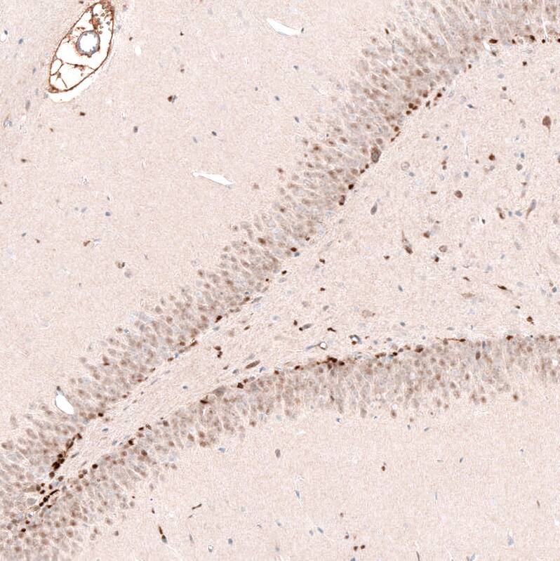 Staining of rat brain shows strong nuclear positivity in a subset of neuronal cells in dentate gyrus.