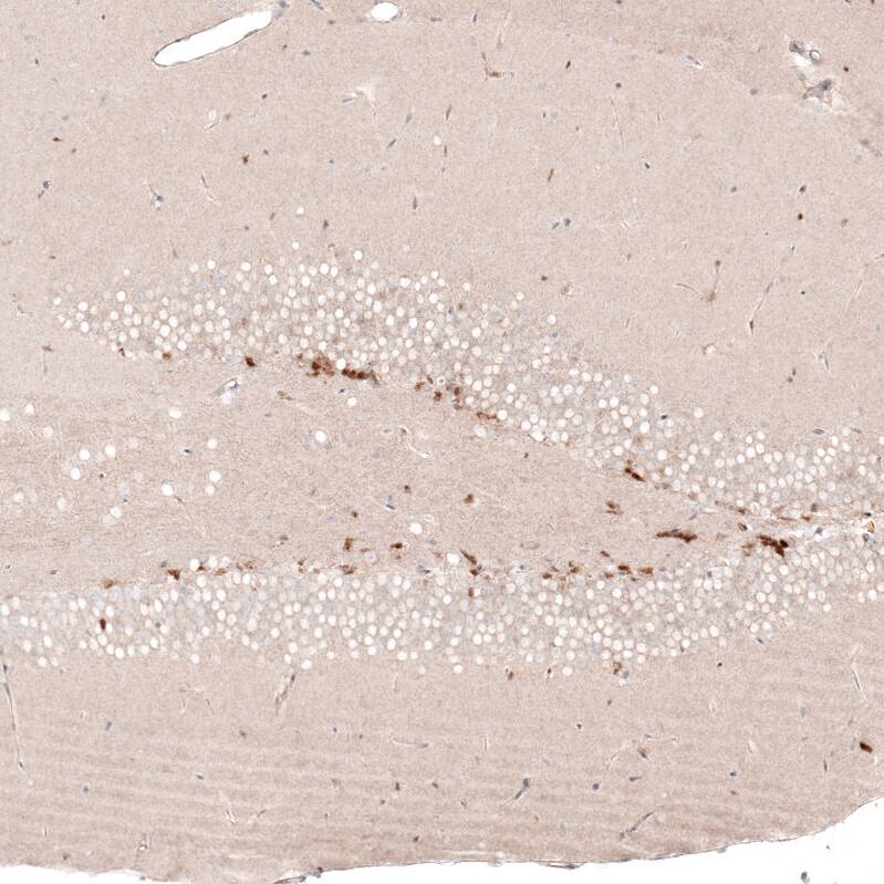 Staining of mouse dentate gyrus shows strong nuclear positivity in a subset of neuronal cells.
