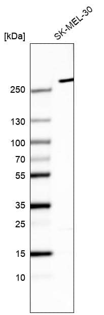 Analysis in human cell line SK-MEL-30.