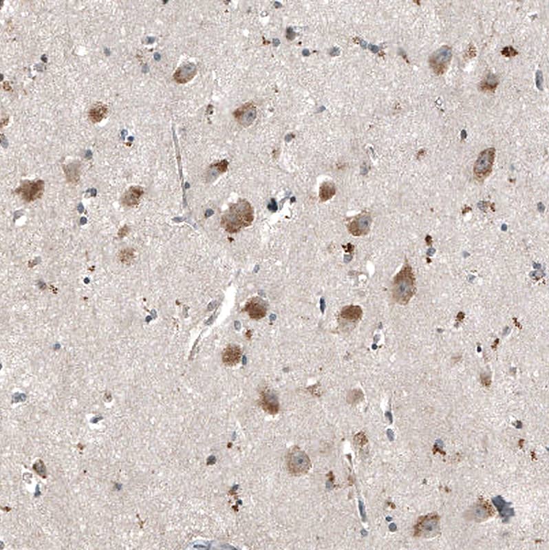 Staining of human cerebral cortex shows strong cytoplasmic positivity in neurons.