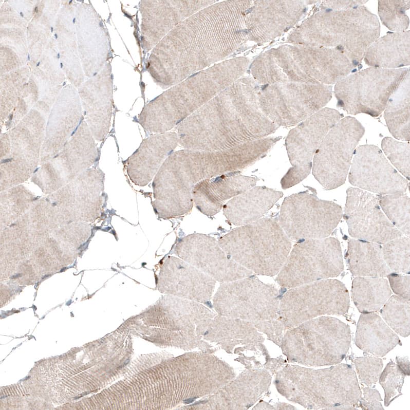 Staining of human skeletal muscle shows very weak cytoplasmic positivity in myocytes as expected.