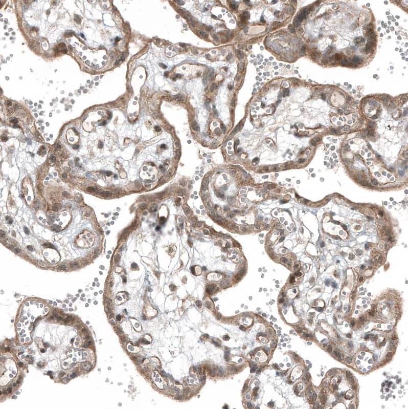 Staining of human placenta shows moderate  cytoplasmic positivity in trophoblastic cells.