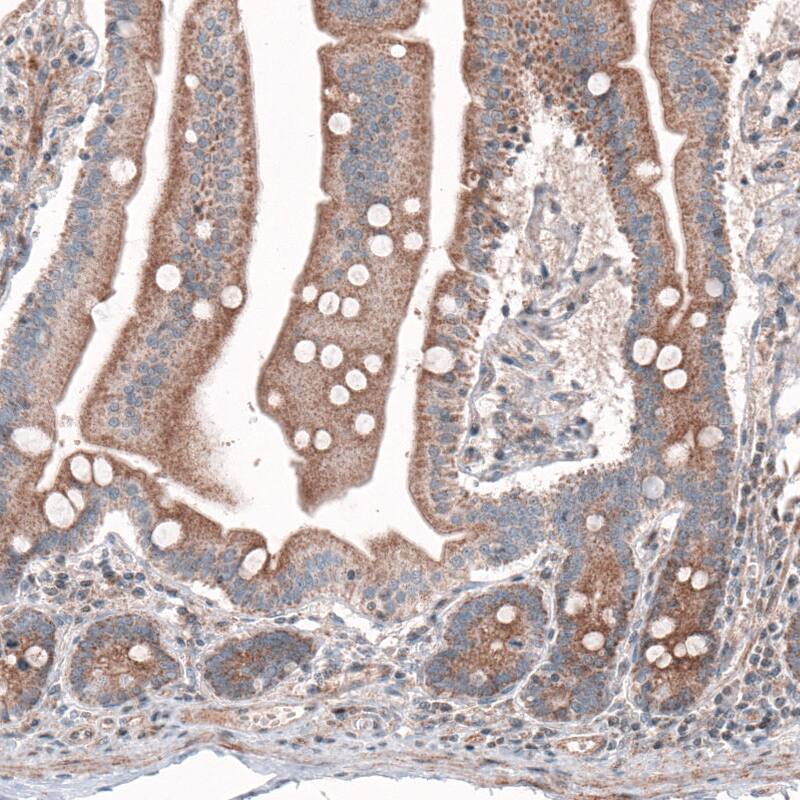 Immunohistochemistry-Paraffin G6PC Antibody (CL5818) - Azide and BSA Free