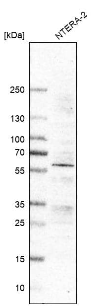 Analysis in human cell line NTERA-2.