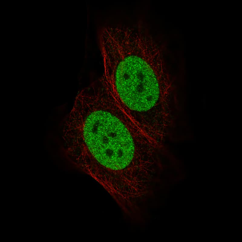 Staining of MCF7 cells, showing specific staining in the nucleoplasm in green. Microtubule- and nuclear probes are visualized in red and blue, respectively (where available).