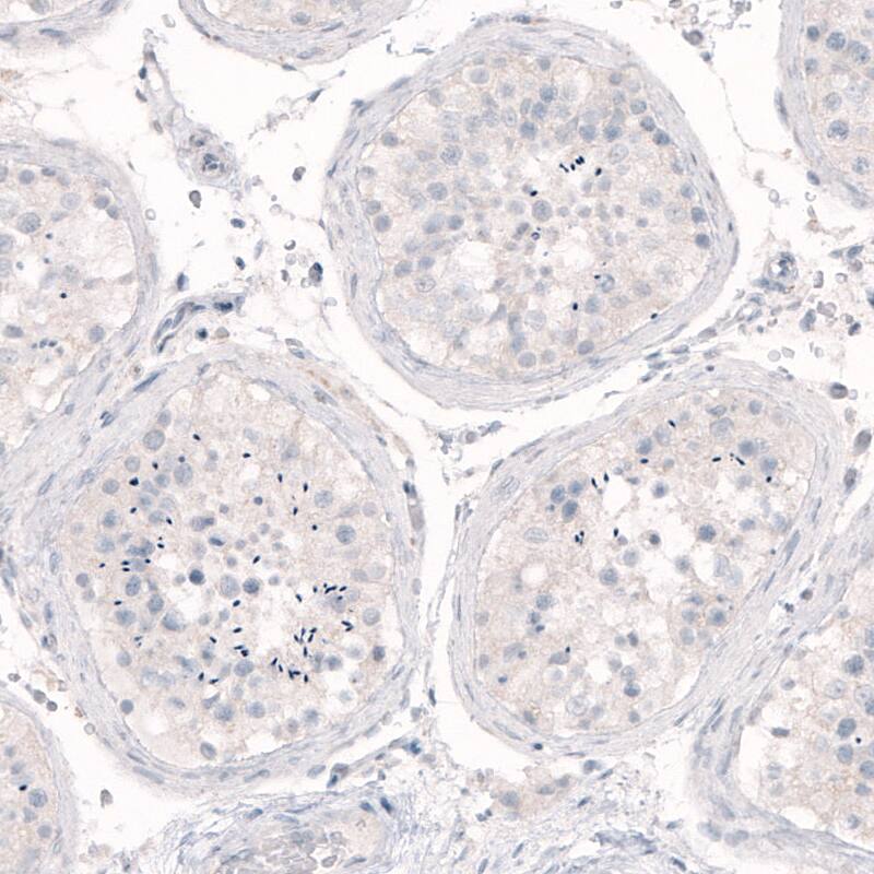 Staining of human testis shows absence of positivity as expected (negative control).
