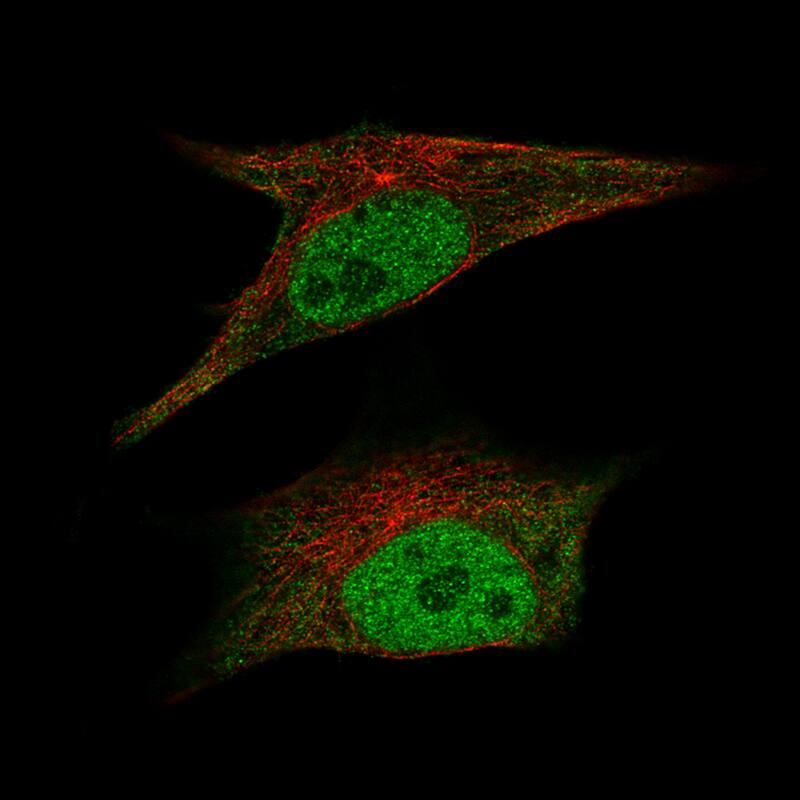 Staining of SK-MEL-30 cells, showing specific staining in the nucleoplasm and cytosol in green. Microtubule- and nuclear probes are visualized in red and blue, respectively (where available).