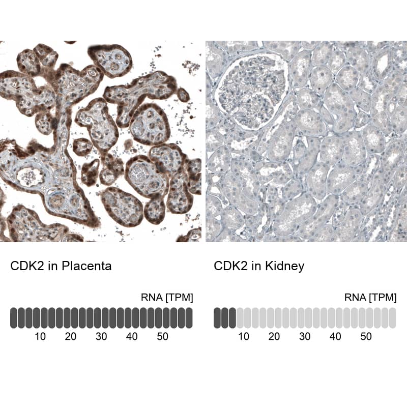 Analysis in human placenta and kidney tissues using NBP3-44198 antibody. Corresponding CDK2 RNA-seq data are presented for the same tissues.