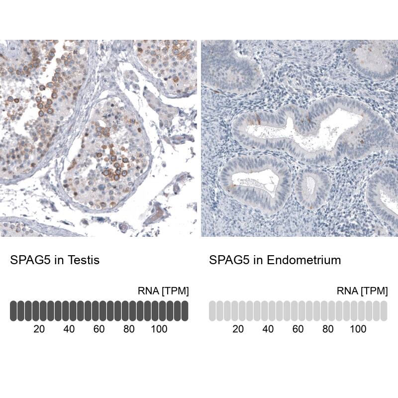 Analysis in human testis and endometrium tissues using NBP3-44199 antibody. Corresponding Astrin RNA-seq data are presented for the same tissues.