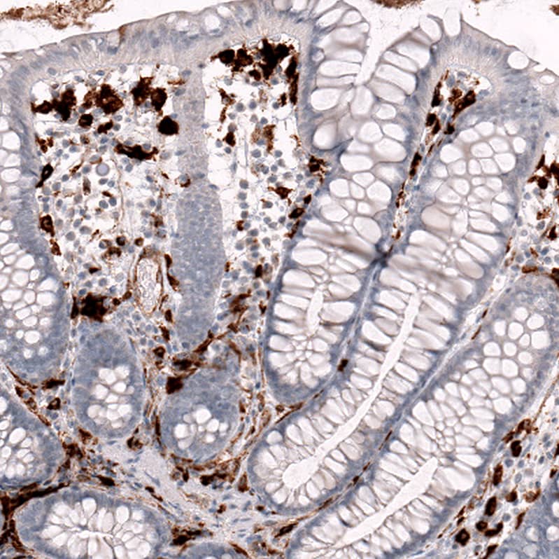 Staining of human colon shows strong cytoplasmic positivity in lymphoid cells.