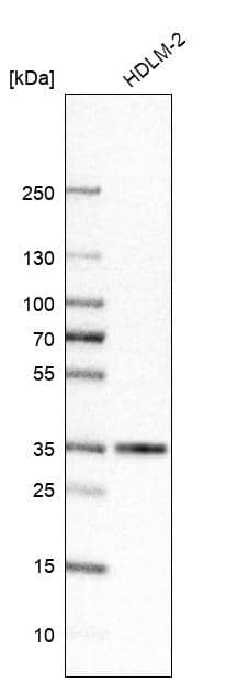 Analysis in human cell line HDLM-2.