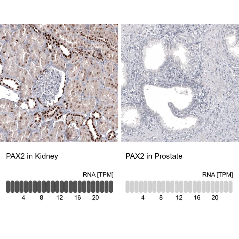 Analysis in human kidney and prostate tissues using NBP3-44202 antibody. Corresponding Pax2 RNA-seq data are presented for the same tissues.