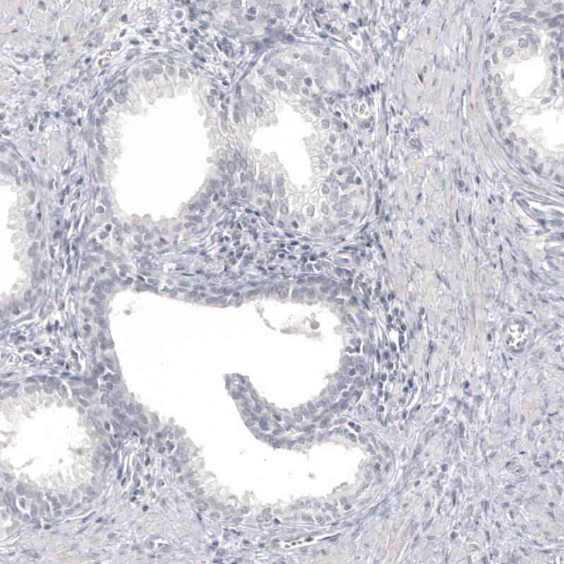 Staining of human prostate shows no positivity in glandular cells as expected.