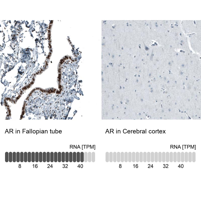 Analysis in human fallopian tube and cerebral cortex tissues using NBP3-44204 antibody. Corresponding Androgen R/NR3C4 RNA-seq data are presented for the same tissues.
