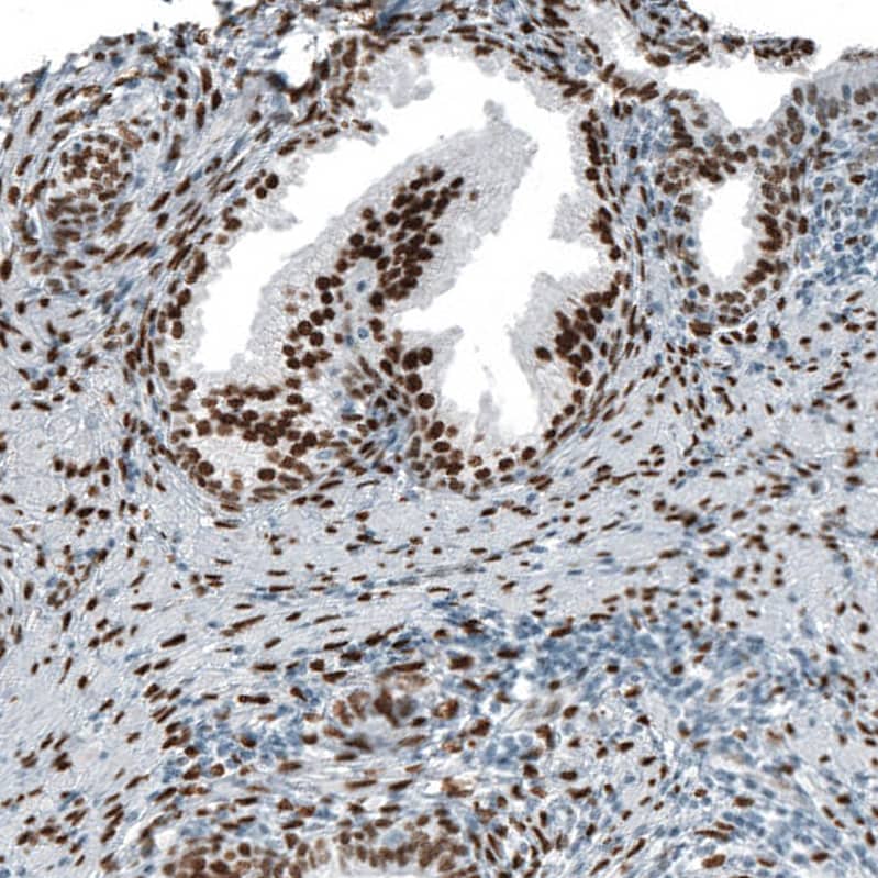 Staining of human prostate shows strong nuclear positivity in glandular cells.