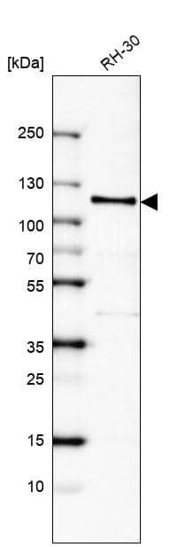 Analysis in human cell line RH-30.