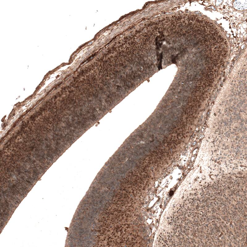 Staining of mouse embryo E14 shows moderate nuclear positivity in neuronal cells of developing cerebral cortex.