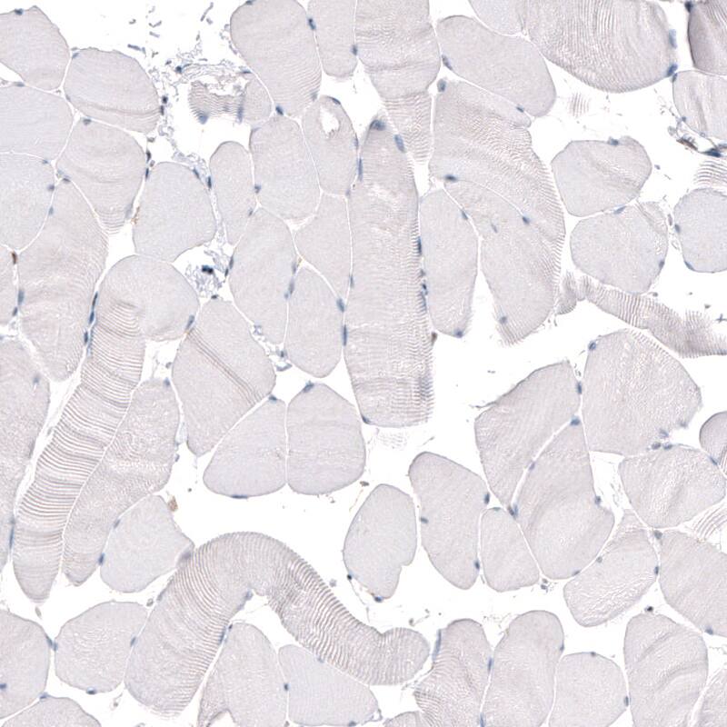Staining of human skeletal muscle shows absence of positivity in striated muscle fibers as expected (negative control).