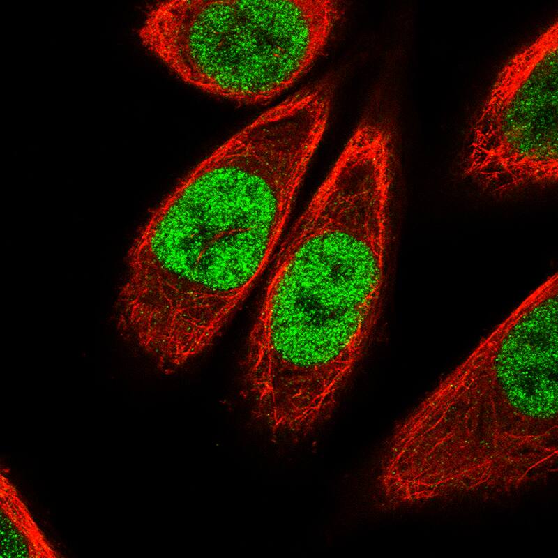 Staining of PC-3 cells using the Anti-KLF4 monoclonal antibody) . 