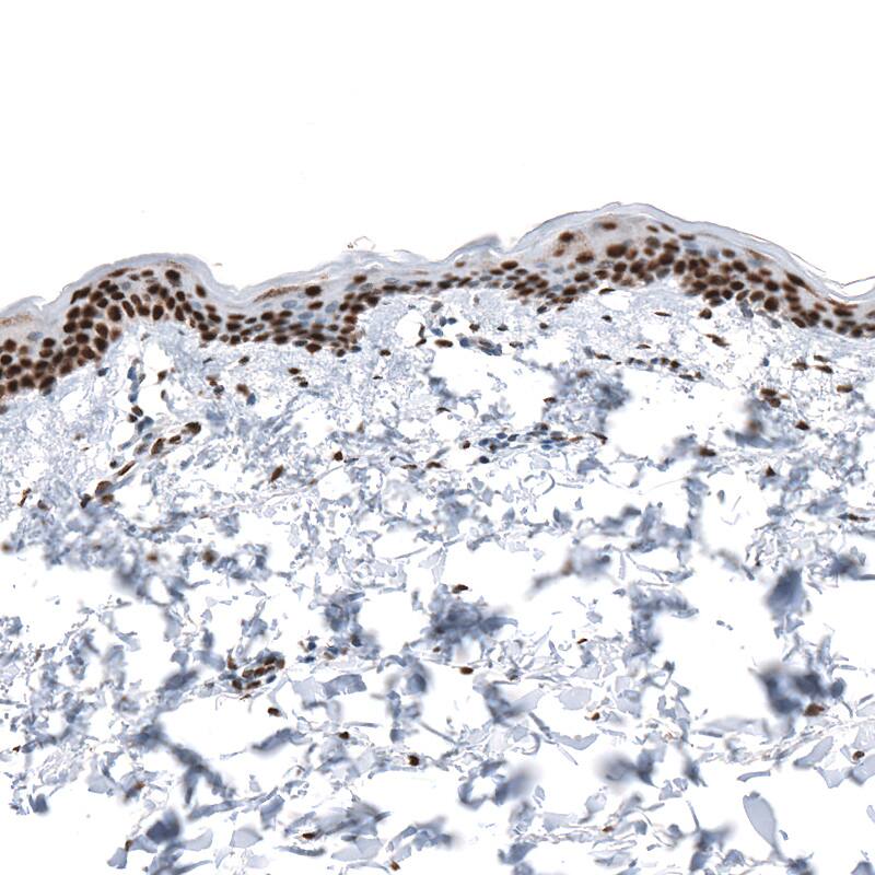 Staining of human skin shows strong nuclear positivity in epithelial cells.