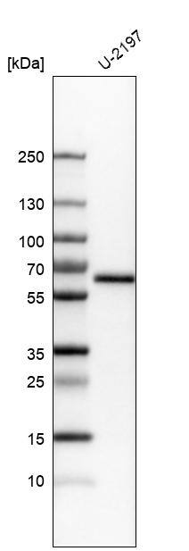 Analysis in human cell line U-2197.